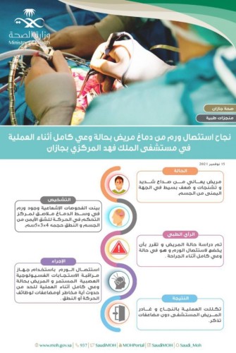 نجاح إستئصال ورم من دماغ مريض بحالة وعي كامل أثناء العملية في مستشفى الملك فهد المركزي بجازان