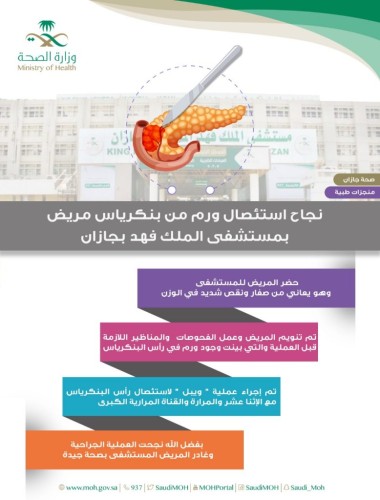 نجاح عملية استئصال ورم في البنكرياس لمريض بمستشفى الملك فهد بجازان
