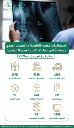 إجراء أكثر من 39 ألف فحص تشخيصي بالأشعة بمستشفى الملك فهد بالمدينة المنورة