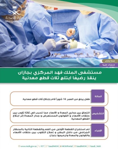 التصقوا بين جداري المعدة والأمعاء .. فريق طبي ينقذ طفل ابتلع 3 قطع معدنية بجازان