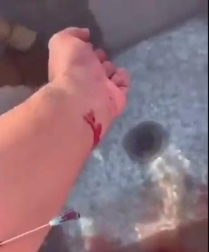 أول رد  من أبن حثلين بشأن الفيديو المتداول  لأشخاص يلوثون  مياة شرب  الأبل بدمائهم !