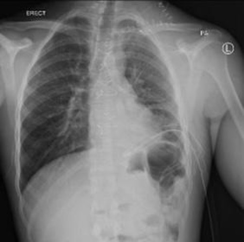 مسار الإصابات في تجمع الرياض الصحي الأول ينقذ حياة شاب تعرض للطعن