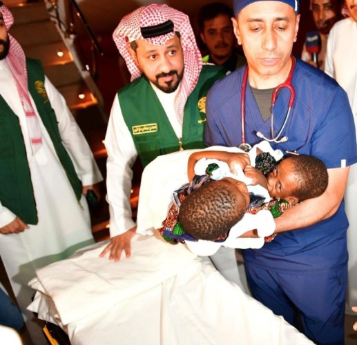 إنفاذًا لتوجيهات خادم الحرمين الشريفين وسمو ولي العهد .. وصول التوأم السيامي التنزاني “حسن وحسين” إلى الرياض