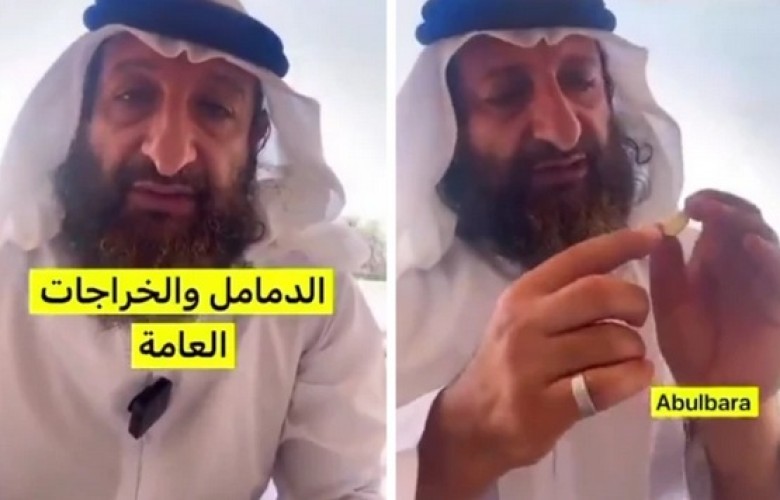 “علاج طبيعي للدمامل والخراج”.. فيديو: معالج شعبي يقدم طريقة فعالة باستخدام الثوم والحجامة