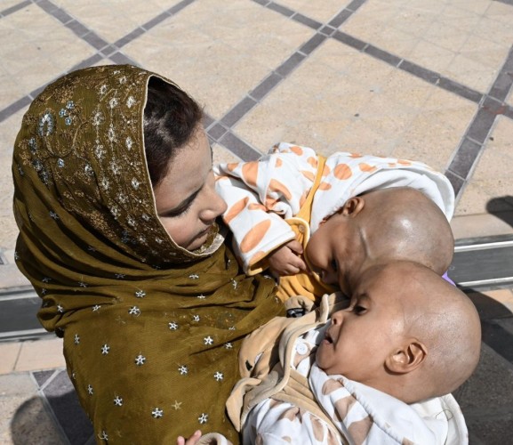 إنفاذًا لتوجيهات القيادة.. وصول التوأم السيامي الباكستاني “سفيان ويوسف” إلى الرياض