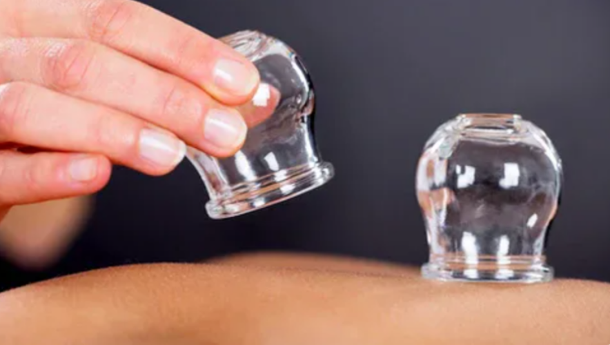 الطب البديل: زيادة الدم المخرج في الحجامة لا تعني فاعلية علاجية أكبر