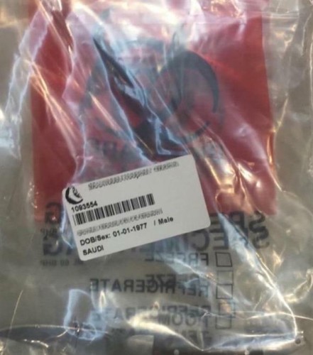 طالب يتربص بمدير مدرسته الثانوية ويسدّد طعنة غائرة في كتفه أثناء “الفسحة”