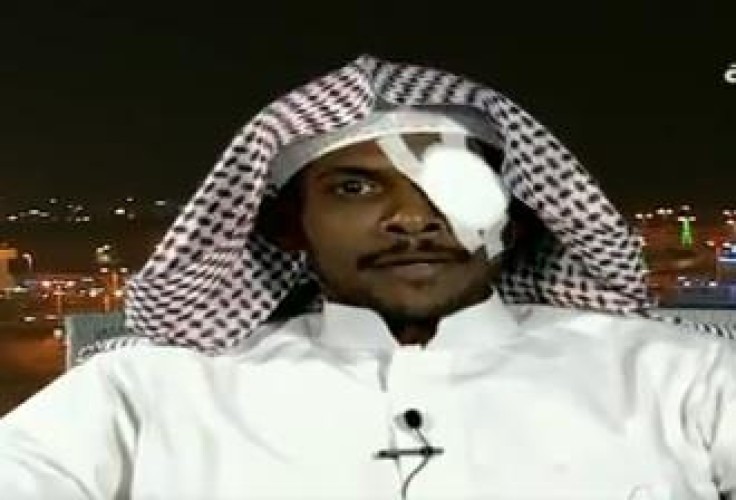 حارس الأمن المعتدى عليه في “مستشفى بيش” يكشف تفاصيل إصابته.. ويروي ما حدث (فيديو)