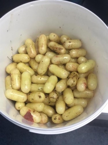 معتمر يحاول تهريب 120 كبسولة حبوب في أحشائه.. وفريق طبي ينقذ حياته بمكة