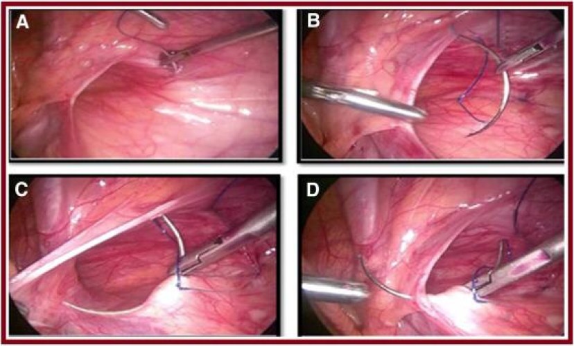 عمليات متقدمة لجراحة الاطفال بيرنامج الخدمات الصحية للهيئة الملكية بالجبيل