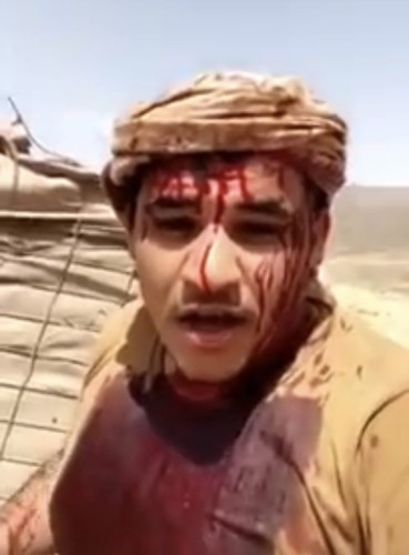 شهيدان نقلاه إلى المستشفى.. الجندي الذي ظهر في فيديو والدماء تغطي ملابسه يوضح الملابسات