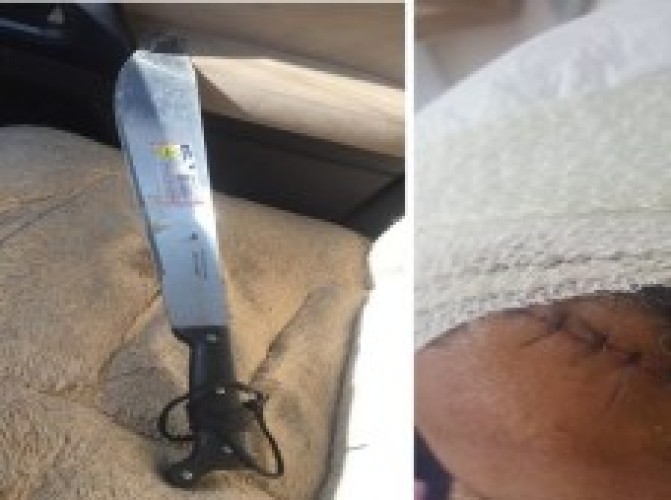 شخص يعتدي على مواطن بساطور أثناء ذهابه لصلاة العشاء بتبوك.. والجهات الأمنية تحقق