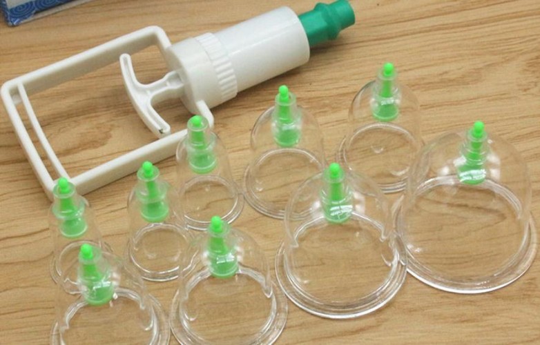 باحث يحذر من تداعيات الحجامة الخاطئة ويوضح الأمراض الناجمة عنها (فيديو)