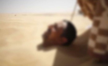 تحذير طبي من “حمَّام الرمل”.. مضاعفاته قد تسبب الوفاة ولا دليل علميًّا على فوائده