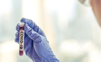 مسؤول أمريكي يعلن إجراء أول اختبار للقاح فيروس “كورونا” اليوم