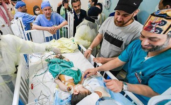 نجاح فصل التوأم السيامي السوري ” إحسان وبسام ” بعد عملية جراحية دقيقة استغرقت 7 ساعات ونصف