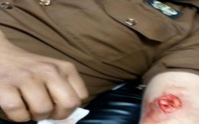 إصابة رجل أمن بـ7 طعنات غادرة أثناء مداهمة وكر لمهربي الحشيش بجازان