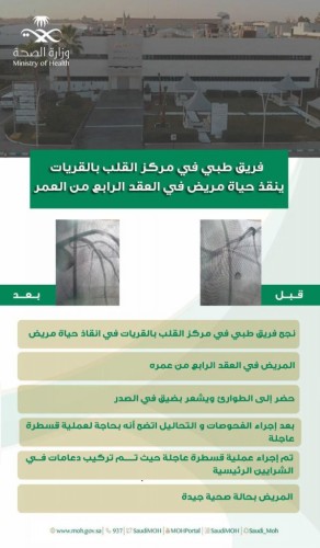 فريق طبي في مركز القلب بالقريات ينقذ حياة مريض في العقد الرابع من العمر