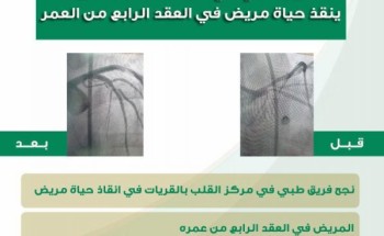 فريق طبي في مركز القلب بالقريات ينقذ حياة مريض في العقد الرابع من العمر فريق طبي في مركز القلب بالقريات ينقذ حياة مريض في العقد الرابع من العمر
