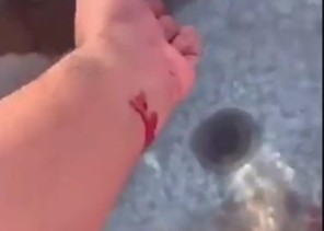 أول رد من أبن حثلين بشأن الفيديو المتداول لأشخاص يلوثون مياة شرب الأبل بدمائهم ! أول رد من أبن حثلين بشأن الفيديو المتداول لأشخاص يلوثون مياة شرب الأبل بدمائهم !