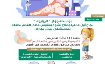 نجـــــاح أول عملية إصلاح تشوه وتقوس عظم القدم لــــــــطفلة بمستشفى بيش بجــــازان