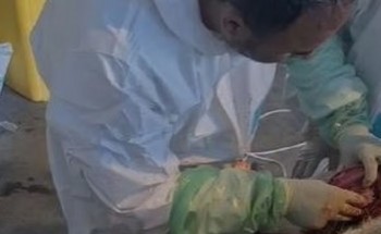 حائل.. تدخّل جراحي نادر يعيد لـ”تيس هولندي” قدرته على المشي طبيعيًا