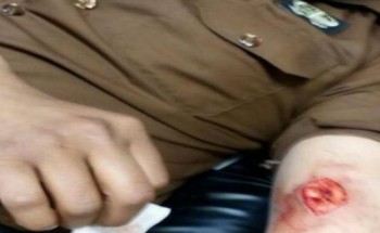 إصابة رجل أمن بـ7 طعنات غادرة أثناء مداهمة وكر لمهربي الحشيش بجازان إصابة رجل أمن بـ7 طعنات غادرة أثناء مداهمة وكر لمهربي الحشيش بجازان