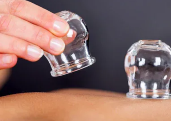 الطب البديل: زيادة الدم المخرج في الحجامة لا تعني فاعلية علاجية أكبر