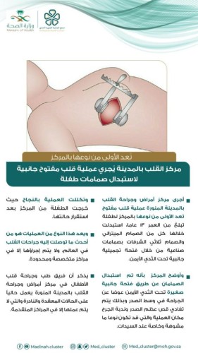 نجاح عملية قلب مفتوح جانبية لإستبدال صمامات لطفلة في مركز القلب في المدينة المنورة