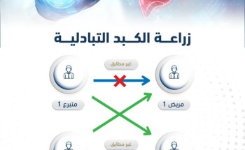 في عملية تعد الأولى من نوعها في الشرق الأوسط نجاح أول زراعة كبد تبادلية في تخصصي الدمام