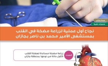 فريق طبي بمستشفى الأمير محمد بن ناصر بجازان يتمكن من زراعة مضخة مساندة لعضلة القلب لمريضة ستينية فريق طبي بمستشفى الأمير محمد بن ناصر بجازان يتمكن من زراعة مضخة مساندة لعضلة القلب لمريضة ستينية