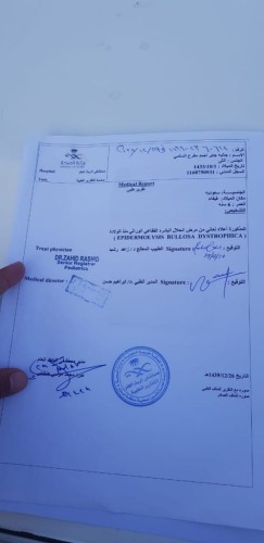 مرض خطير يهاجم الطفلة جالية السلمي ووالدها يناشد بعلاجها